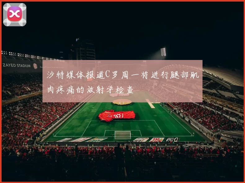 沙特媒体报道C罗周一将进行腿部肌肉疼痛的放射学检查